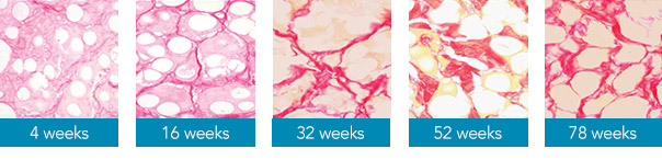 Histology slides at different intervals of time