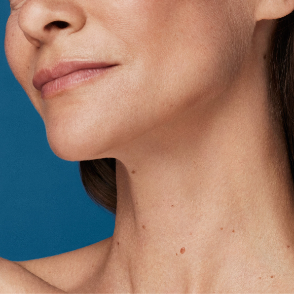 Photo of lower half of woman's face and neck.