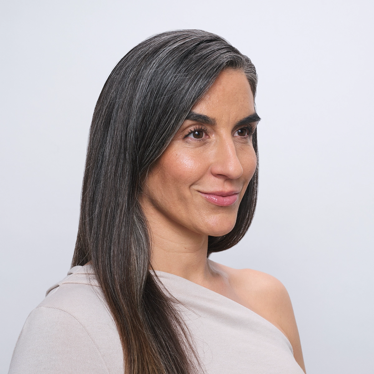 Woman smirking and showing effects of Radiesse on skin.